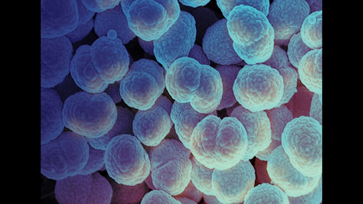 Alaskan Woman's Death From Gonorrhea Sparks Fears of a New Strain