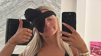 Love Island's Chloe Burrows sparks concern as she shows off swollen face before sporting an eyepatch amid mystery ailment