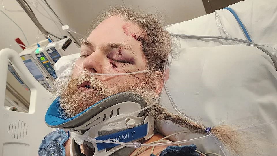 Man with special needs suffers horrifying injuries after being struck by a TORNADO