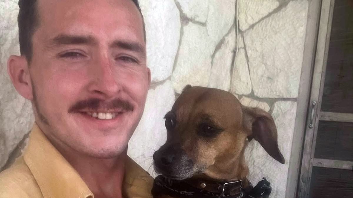Man loses 40% of his skin when he risks his life to save his beloved dog from house fire