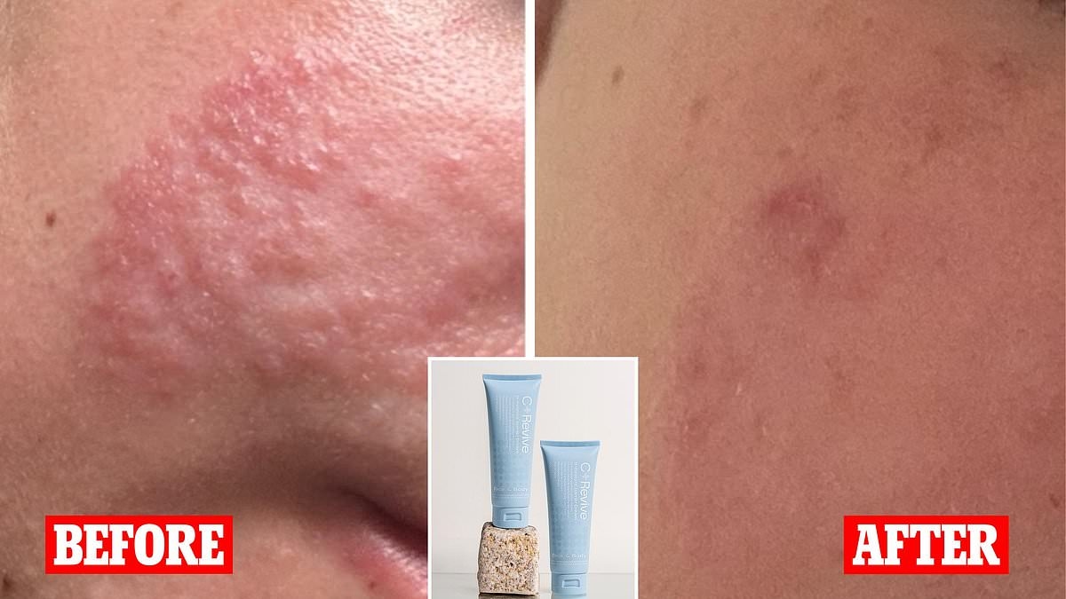 The $29 winter item shoppers swear by for transforming dry skin: 'As good as the hype'