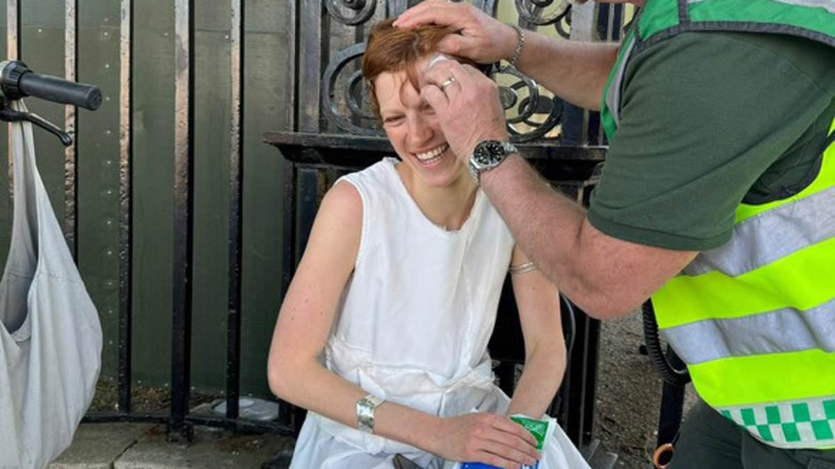 Rise of 'Lime bike leg': That's the epidemic of shattered limbs and mangled knees caused by the 86lb bikes. Now doctors and victims reveal the danger and say: 'I'm NEVER going on one of those again'