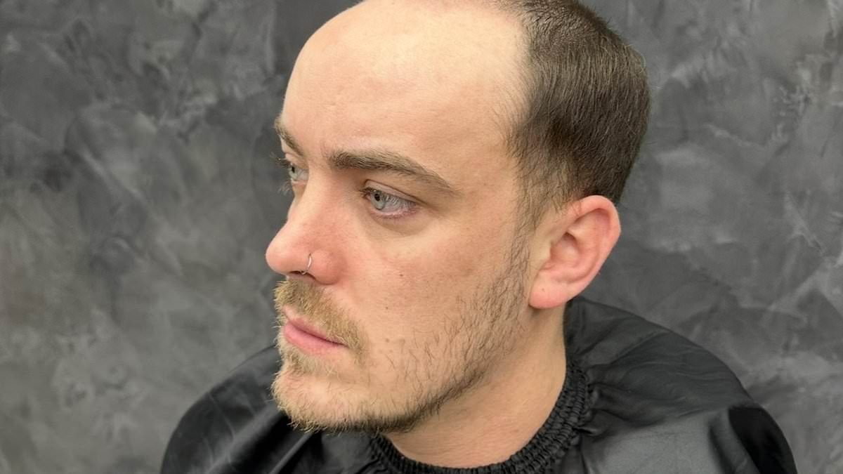 When I started balding in my teens I was so insecure. Then I discovered the hair-loss miracle men whisper about and it changed my life. No, it's NOT a transplant - you'll never guess my secret
