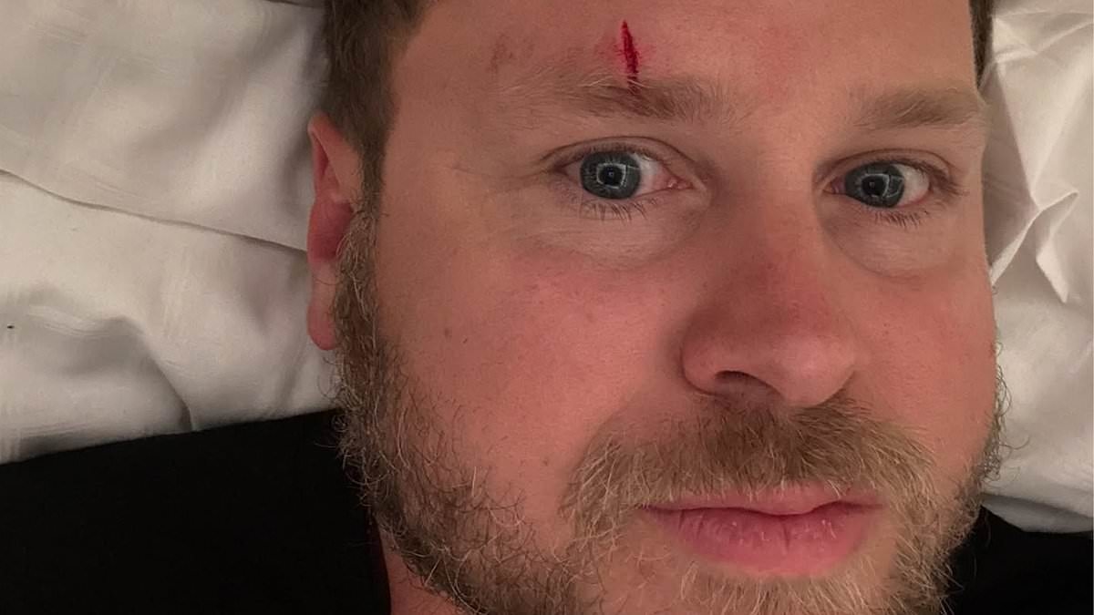 Spencer Pratt horrifies fans with bloody forehead gash as he calmly asks them for treatment tips