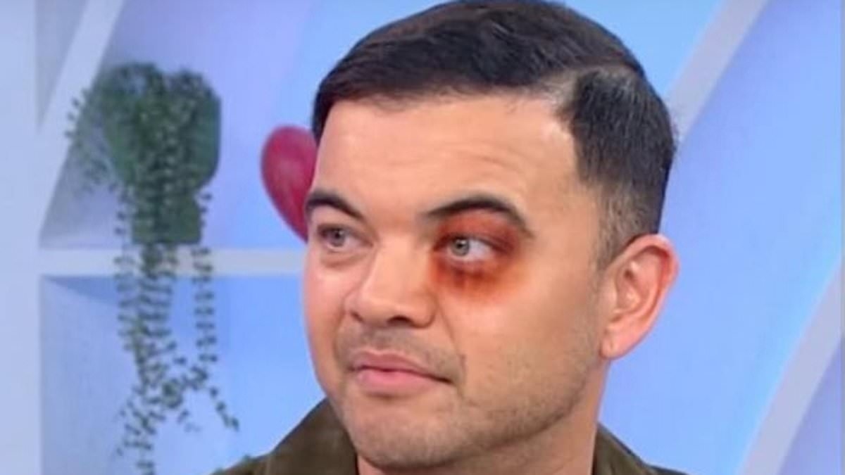 Shock as fans find 'photo' circulating of Guy Sebastian with a black eye after being 'arrested'