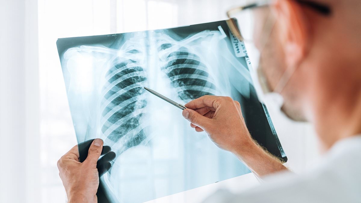 Experts discover alarming culprit behind mystery lung cancer surge in never-smokers... all Britons could be at risk