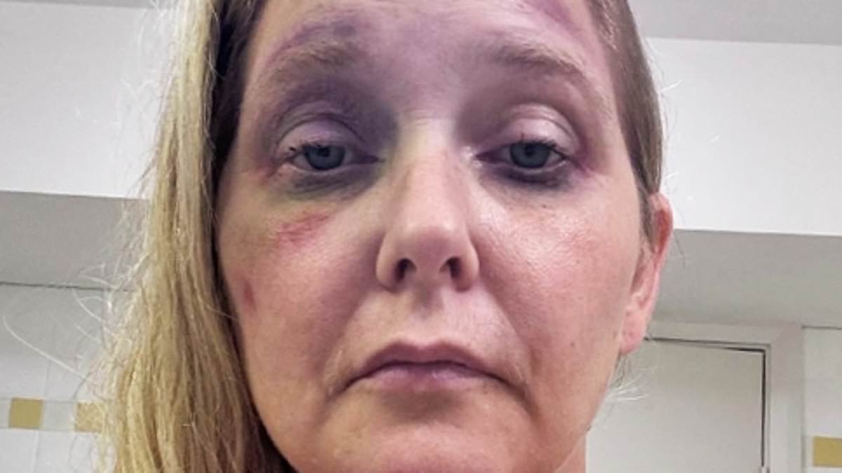 Inside the mystery of shocking new images of Jeffrey Epstein victim Virginia Giuffre, battered and bruised just weeks before she claimed to have four days to live - as her final words to her kids in a suicide note are revealed