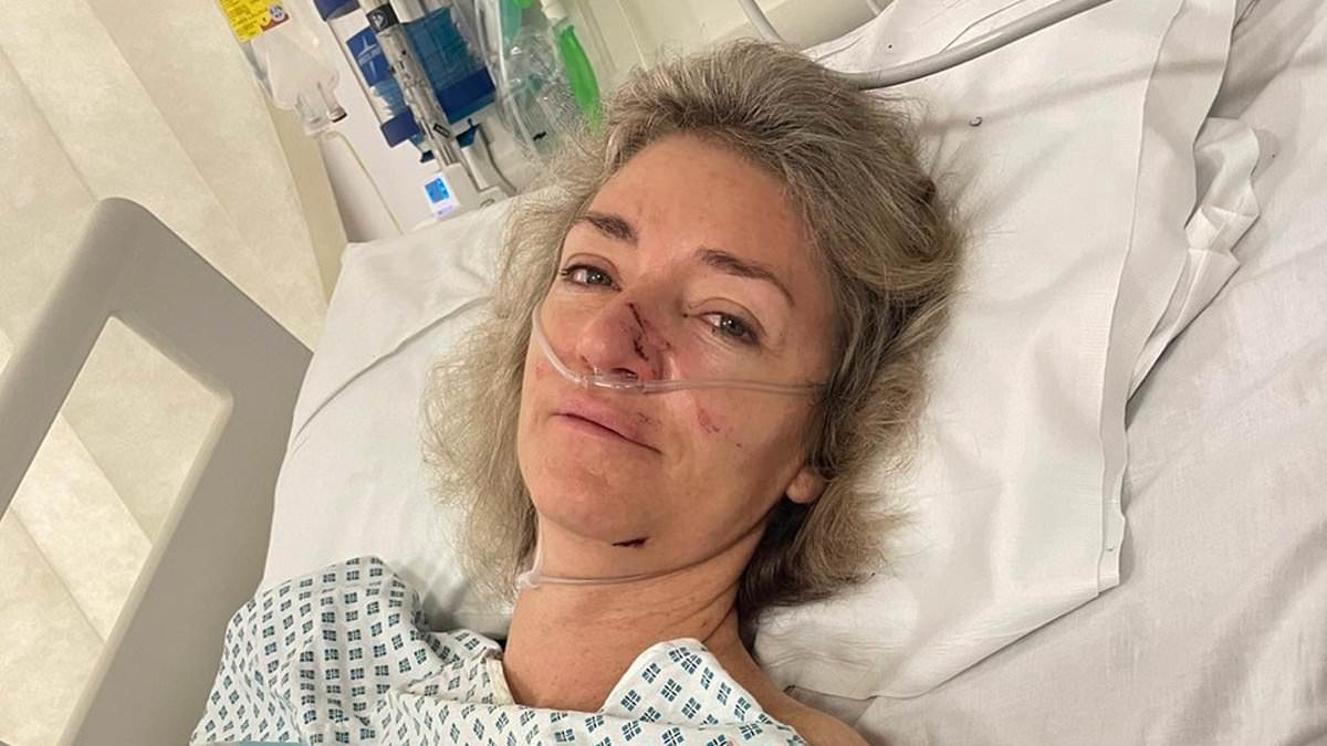 EXCLUSIVE I was run over by two Tube trains and had two limbs amputated after slipping off wet platform - I can never hug my children with both arms again and TFL say it's MY fault