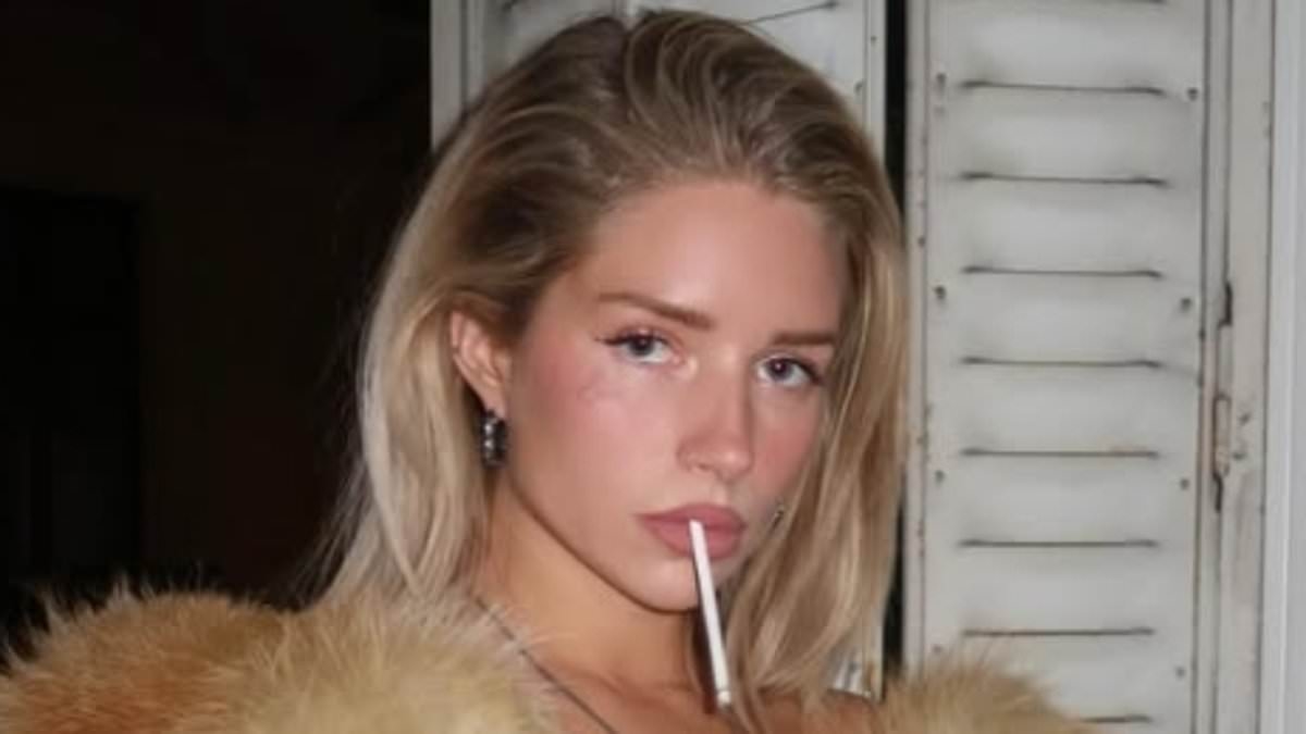 Lottie Moss is writing an autobiography one year after suffering seizure from Ozempic use