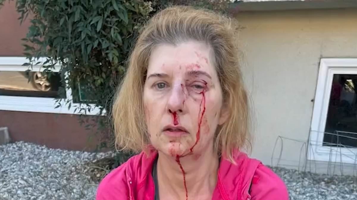 Woman left with broken nose and facial trauma in unprovoked attack by violent homeless man