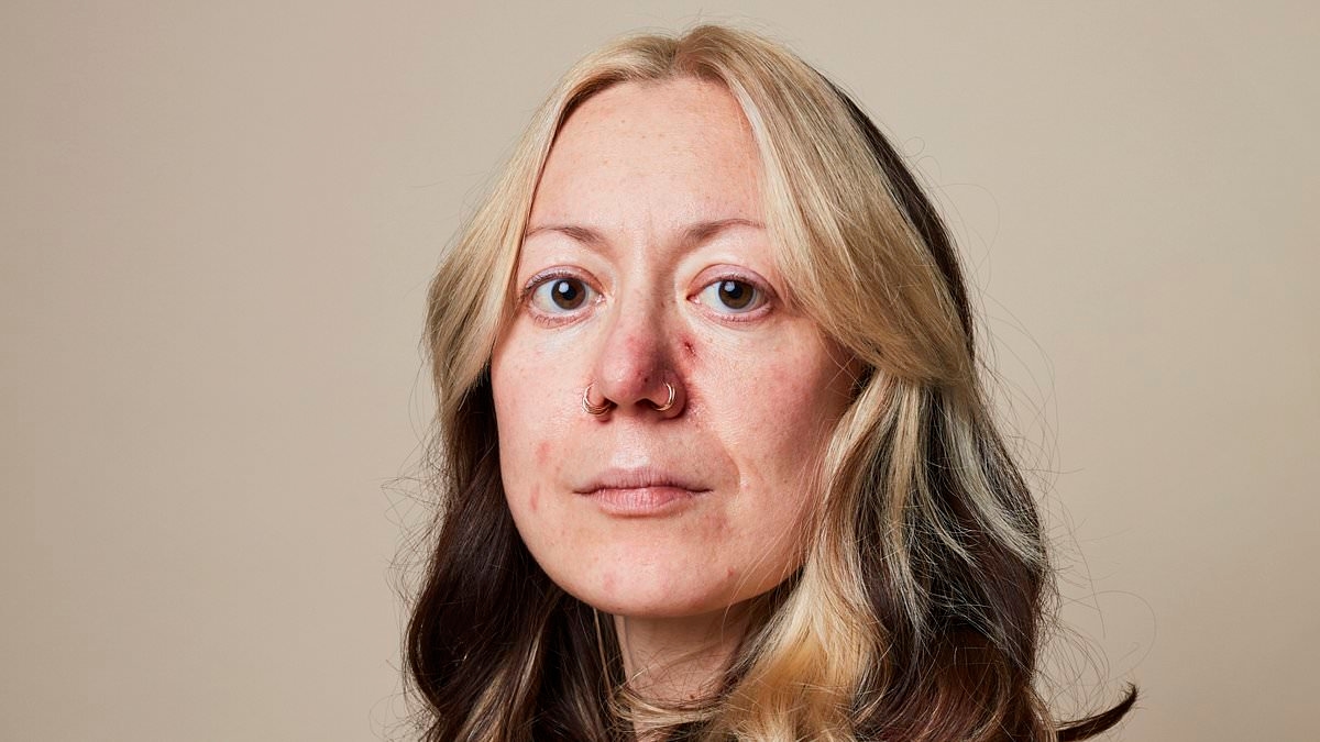 I've spent two decades battling this hidden skin disorder that affects thousands of women. It's taken a huge toll on my life and this is what triggers it: JENNIFER BARTON