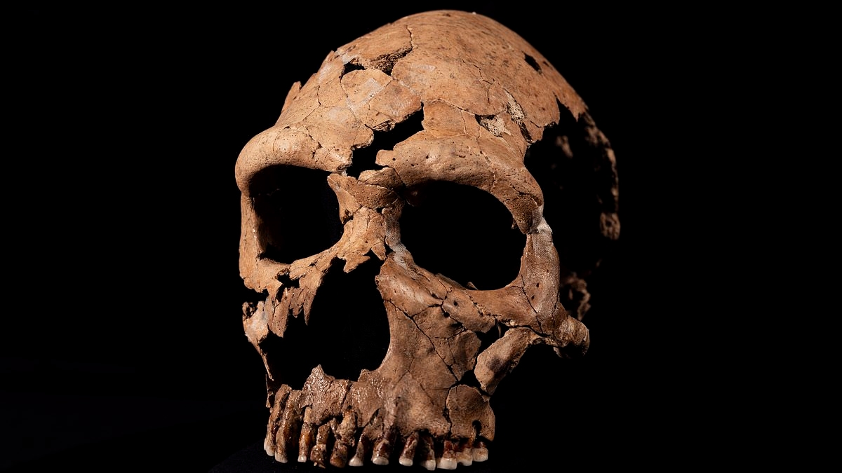 Suffer from headaches? Neanderthal DNA could be to blame, study suggests