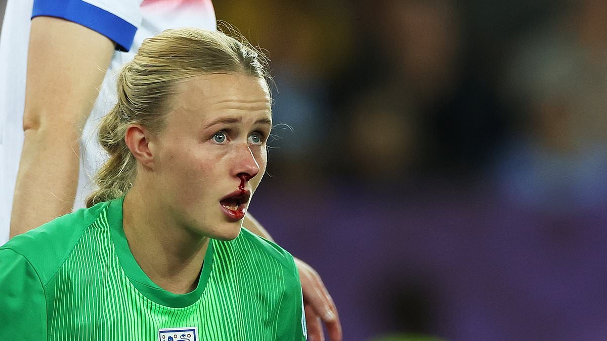 Lionesses' bloodied hero who doctors said couldn't play football: Hannah Hampton is the keeper born with crossed eyes, who struggles to pour a drink. Now she is a European champion after seeing off Mary Earps