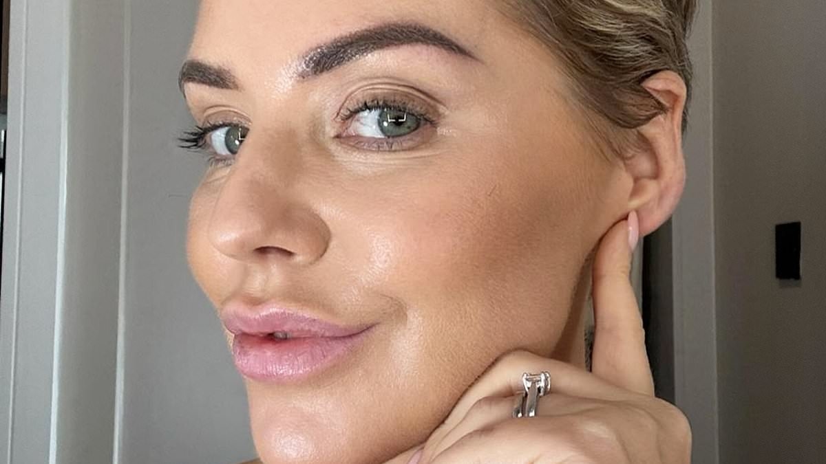 Hollyoaks actress Stephanie Waring discusses being stuck in an 'endless loop' with bulimia during decades-long battle