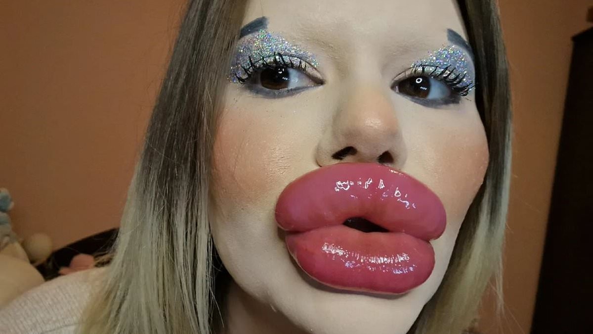 Woman with 'world's biggest lips' reveals what she looked like before surgery