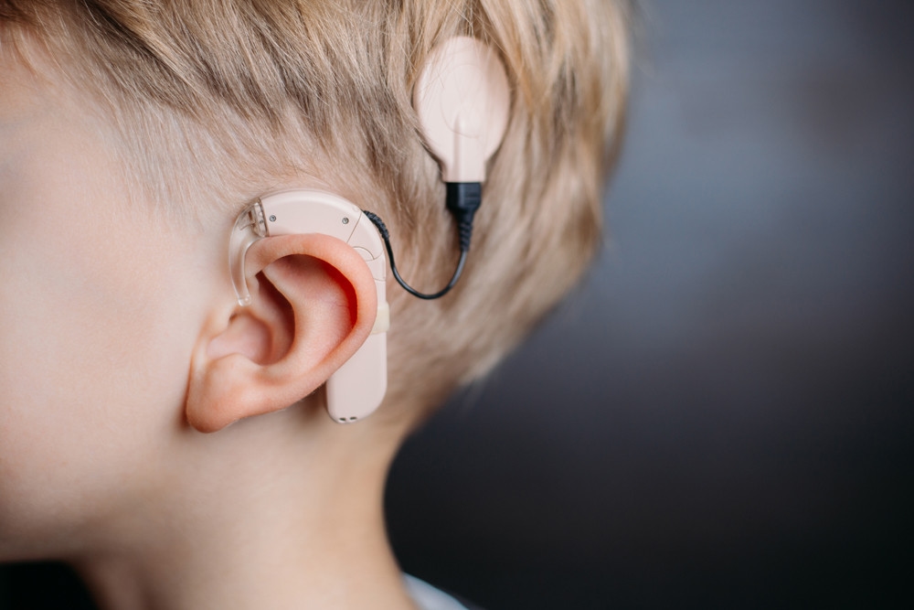 Peshawar launches cochlear implant programme for hearing-impaired children