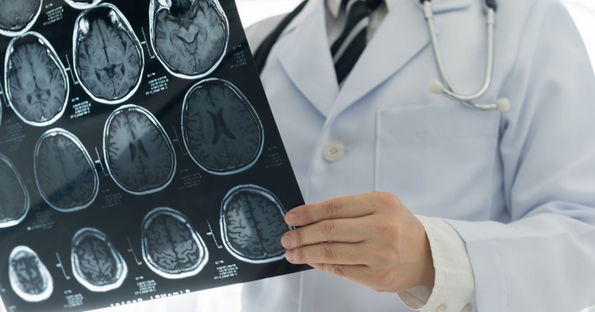 Five simple ways to reduce cholesterol, blood pressure and dementia risk in 20 minutes