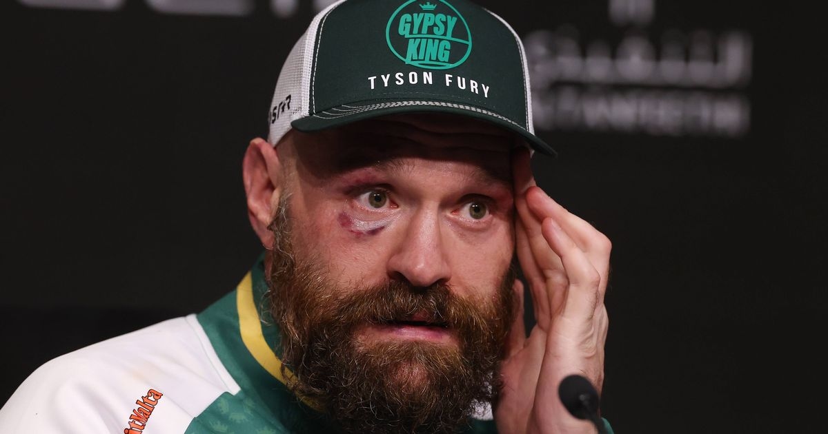 Tyson Fury to be handed immediate  world title shot if he reverses retirement