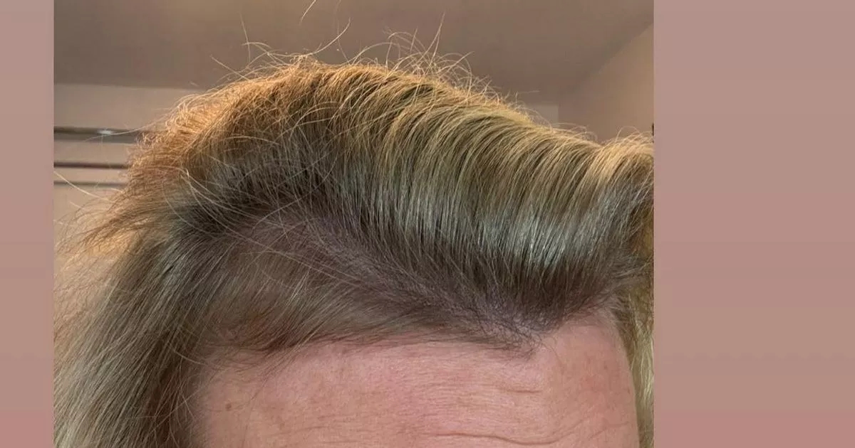 ‘Miracle cure' hair growth supplement makes ‘unbelievable difference' to its thickness