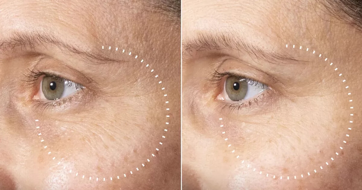 Shoppers say new Medik8 buy made skin visibly brighter in days