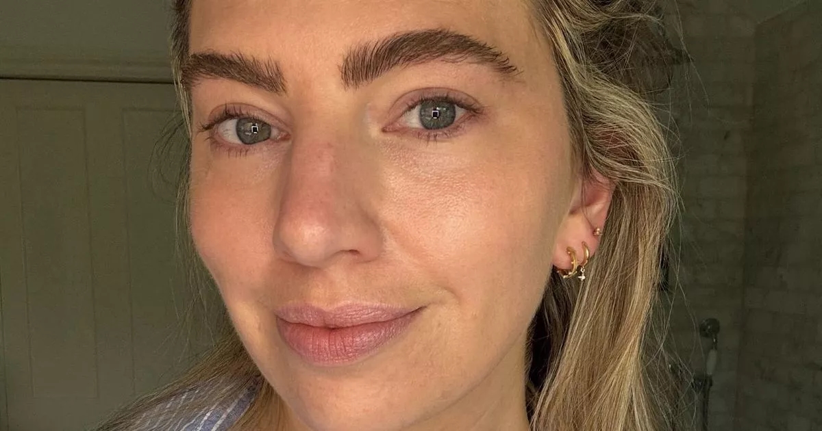 ‘This new vitamin C serum is the only one that doesn't irritate my problem skin'