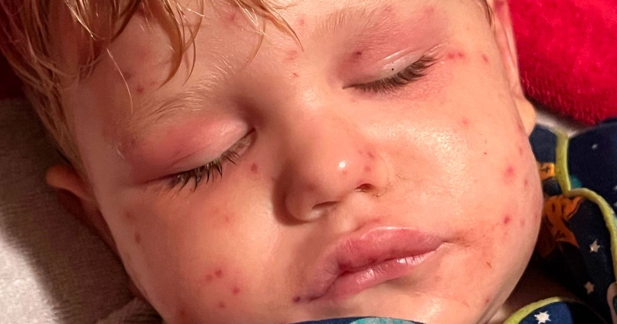 Toddler fighting for his life after being stung 150 times in horror wasp swarm