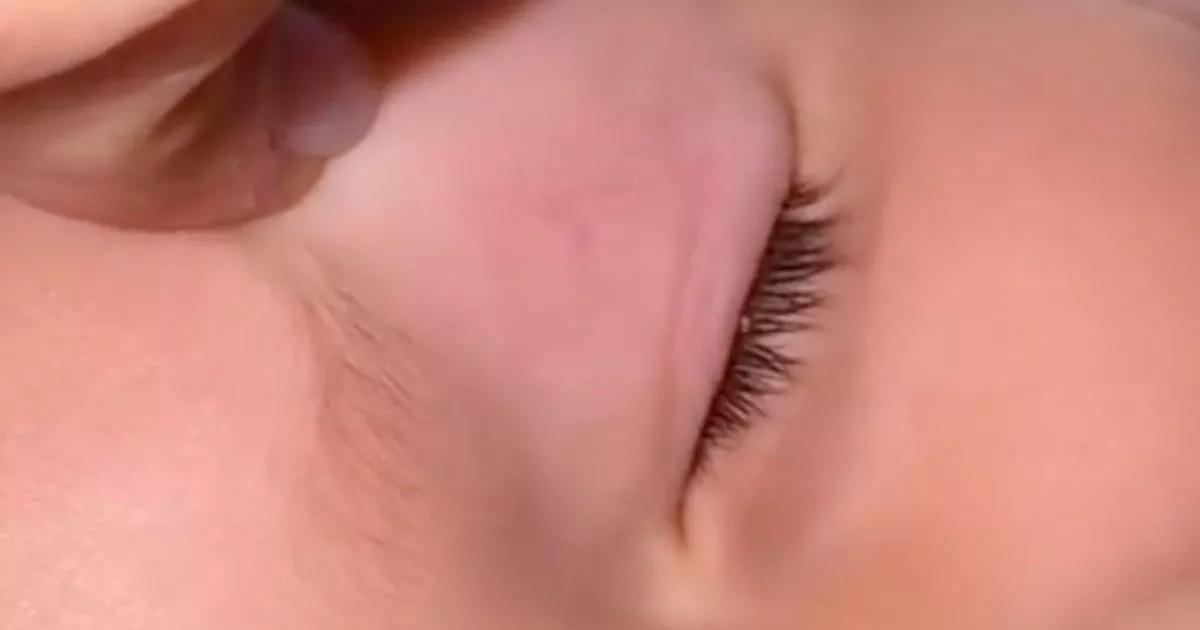 Mum finds something weird on child's eye – then seconds later learns what it is