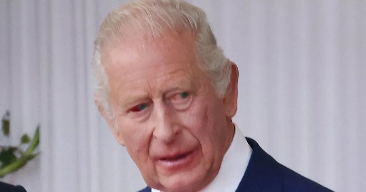 King Charles spotted with bloodshot eye as health condition explained
