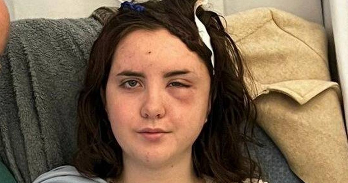 'I was told I had heatstroke from Turkey holiday - reality was scary'