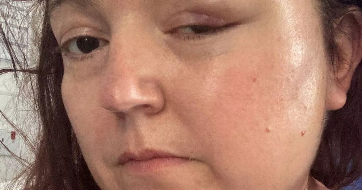 'I was told my symptoms were perimenopause - then I had a seizure'