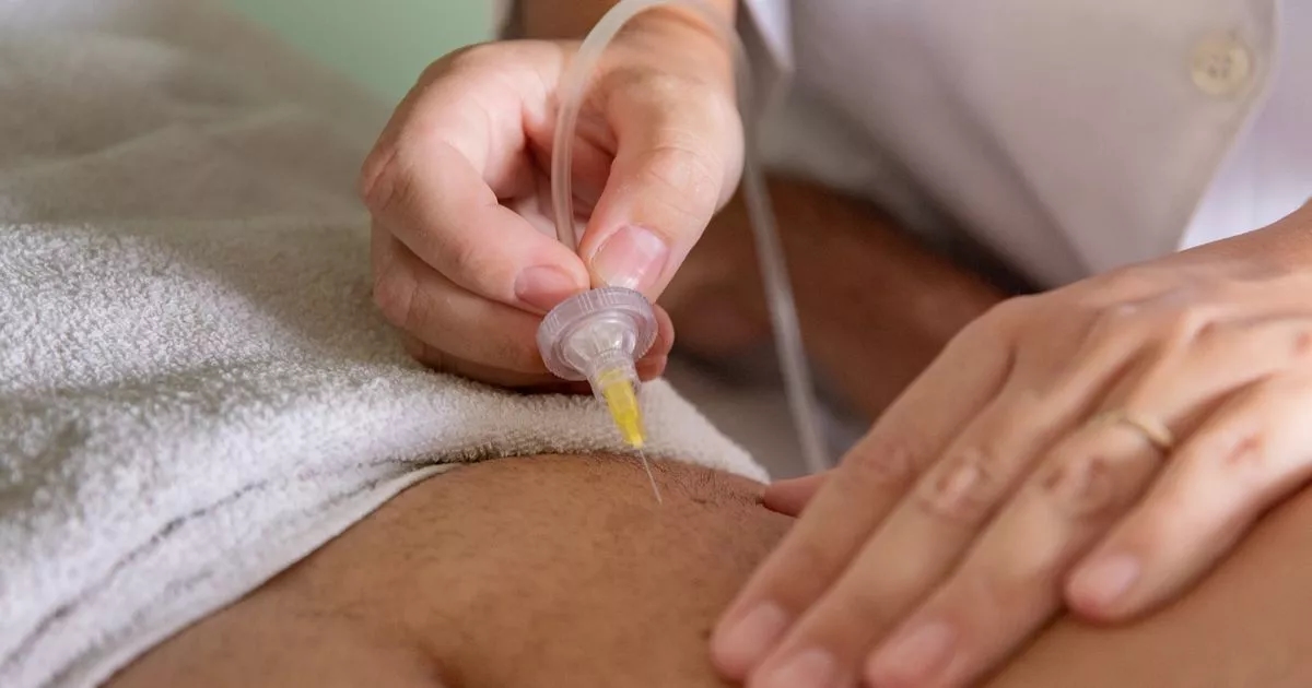 Warning 'lives at risk' over fat injections being given in the UK
