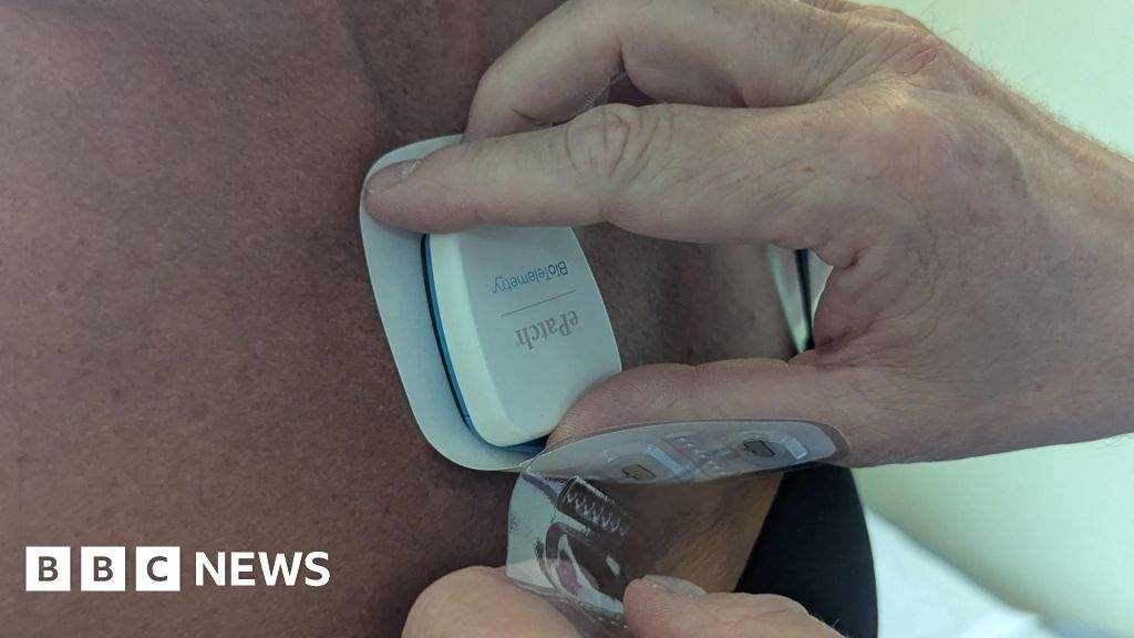 Surrey hospital first to use DIY heart monitors