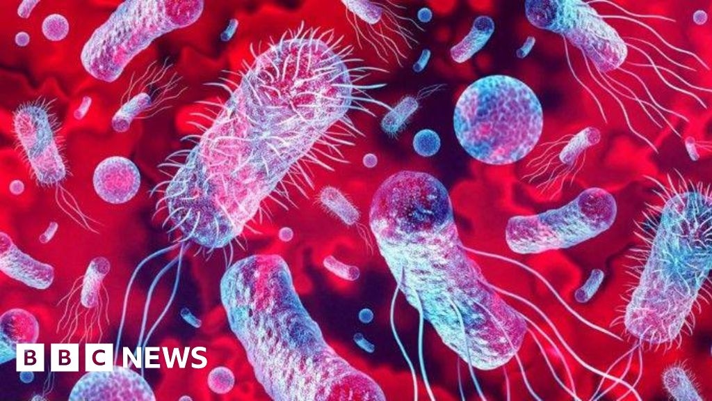 Listeriosis: Adult dies in Republic of Ireland as outbreak investigated