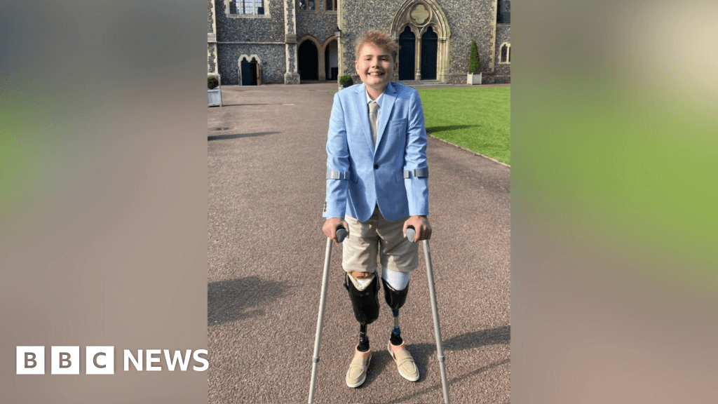 West Sussex boy wants to 'enjoy life' after losing legs to sepsis