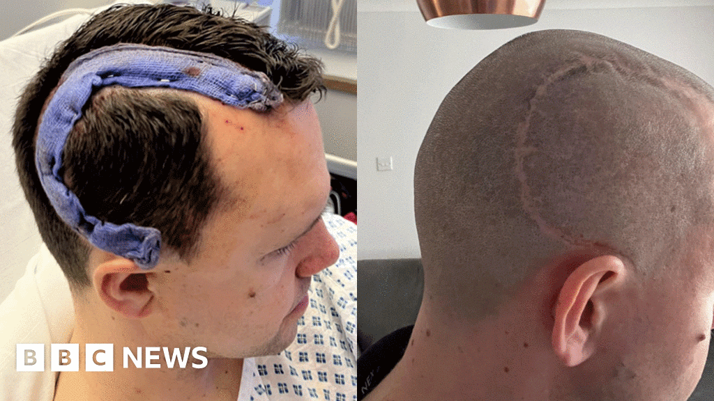 West Hanney man's brain tumour grew 'for more than a decade'