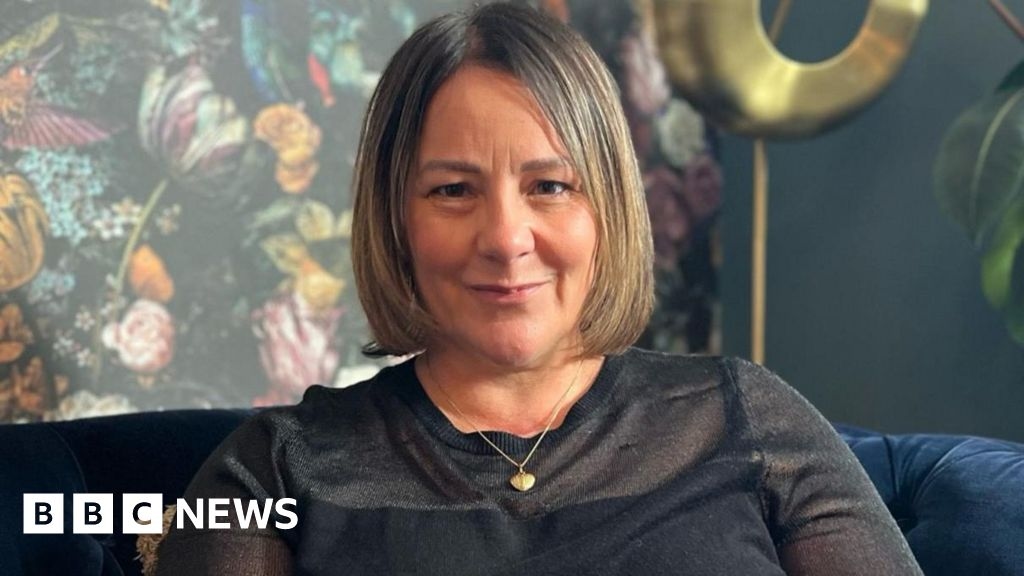 London 7/7 bombings: Survivor hopes scars can help others heal