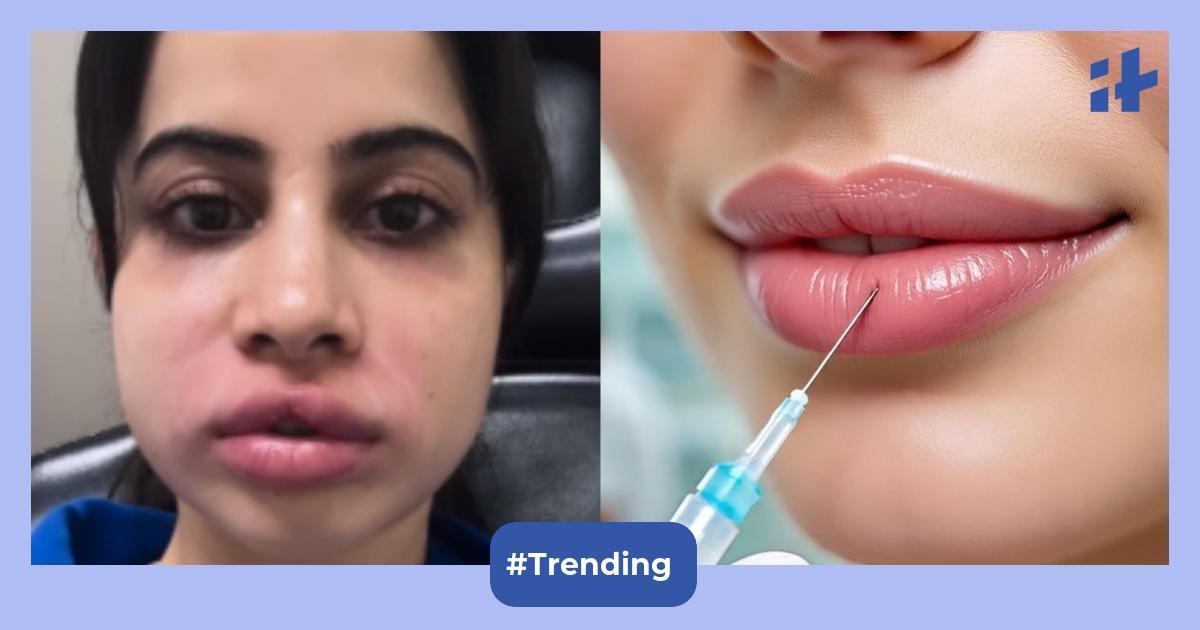 Urfi Javed lip filler saga: Doctor warns of grave risk; says one wrong shot can cause blindness, kill skin cells