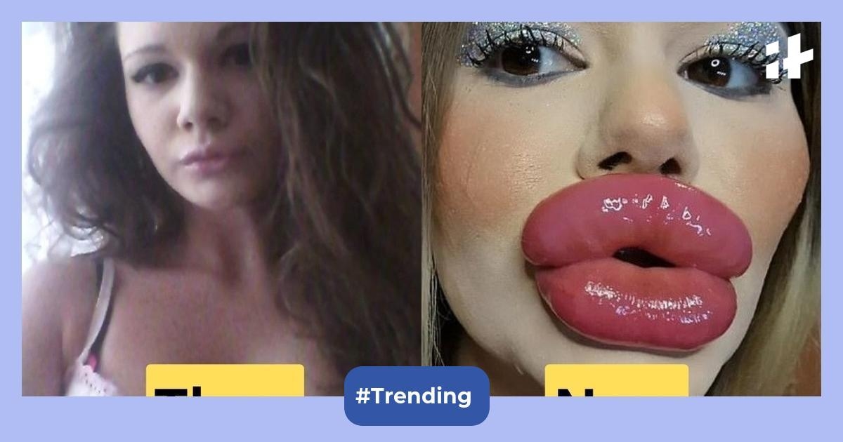 Meet Andrea Ivanova: The woman with the world's largest lips who spent over $26,000 on lip fillers