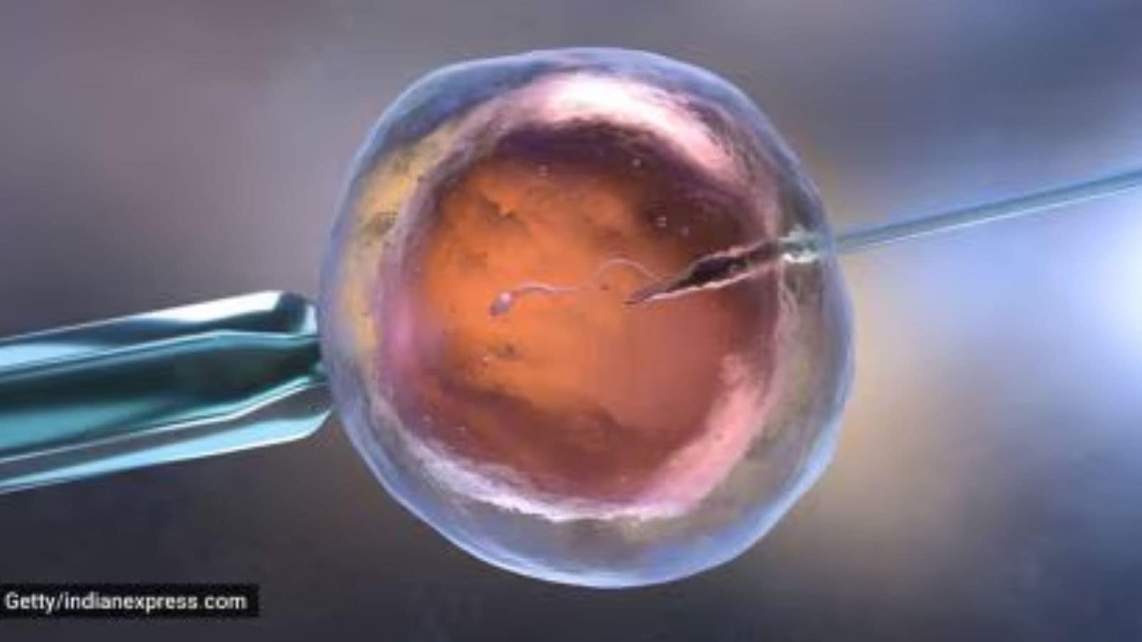 Haryana to mandate prior approval for IVF for couples with girl child