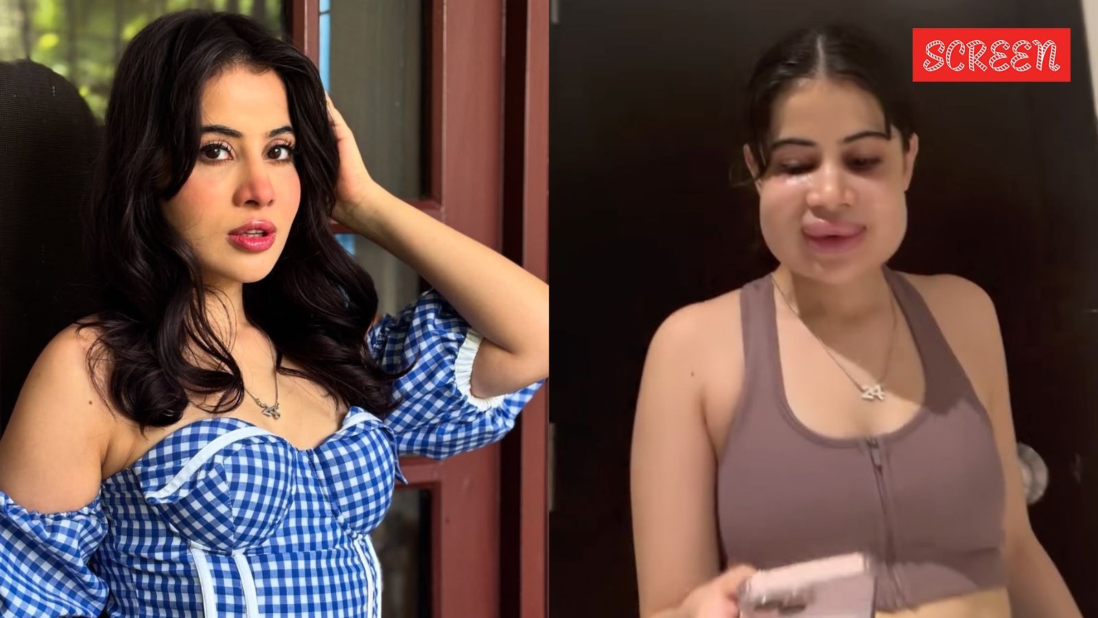 Uorfi Javed shares first pictures after removing lip-fillers, responds to trolling: ‘I had a good laugh'