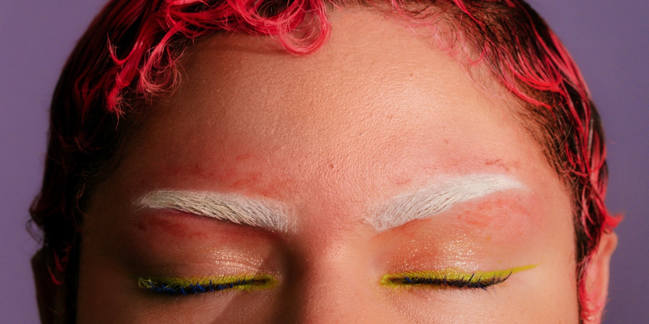 Women Are Saving Thousands of Dollars With DIY Beauty Procedures. It's Not Always Pretty.