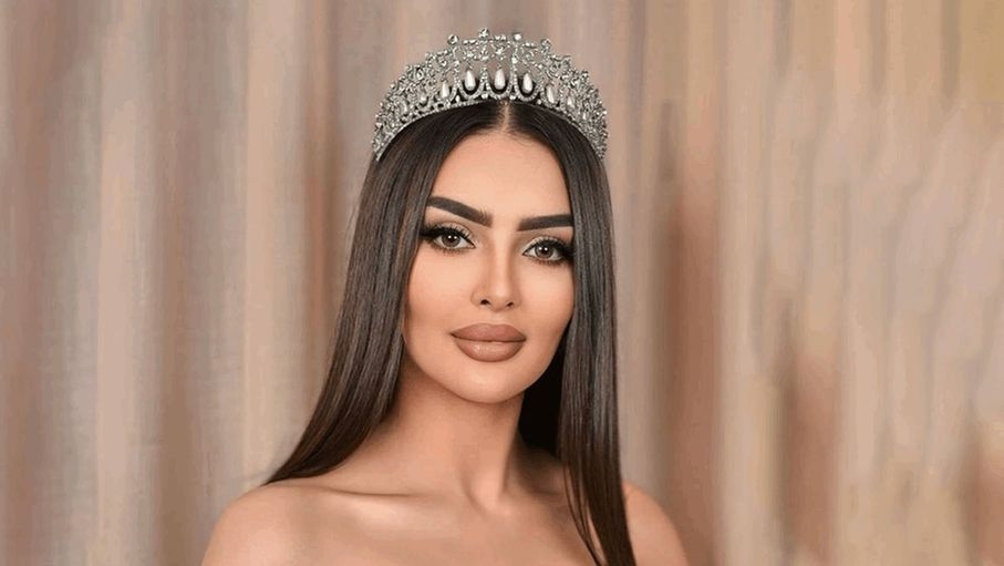 بعد تشوّه وجهها.. هل تفقد رومي القحطاني فرصتها في تمثيل السعودية بمسابقة عالمية؟
