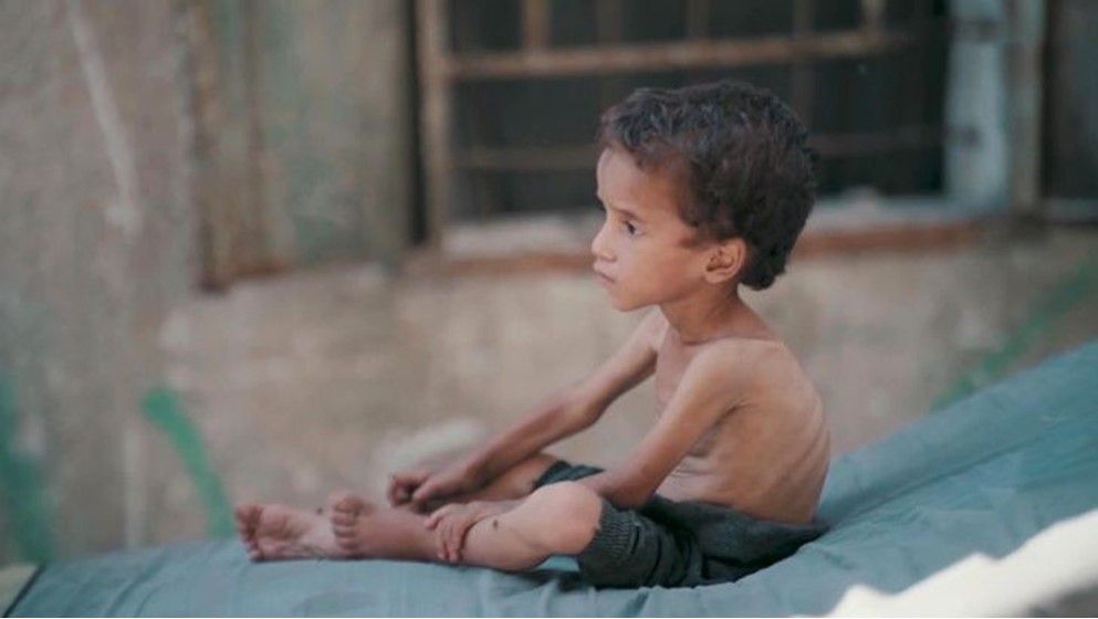 10 Die of Starvation in Gaza Within 24 Hours as UN Official Calls for Sanctions on Israel - Jordan News