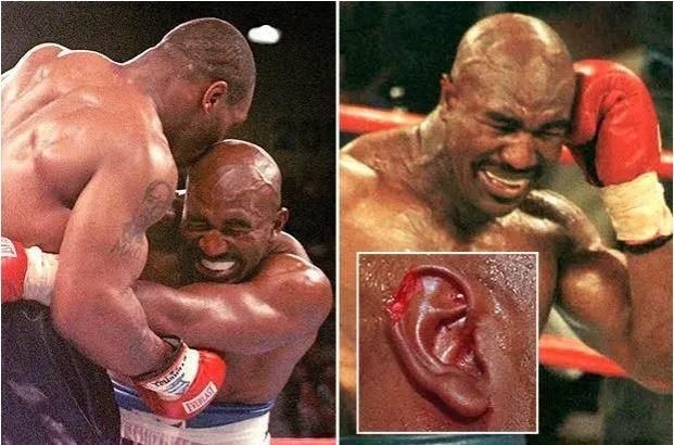 On this day: 'Baddest Man on the Planet' Mike Tyson is punished for biting off an opponent's ear
