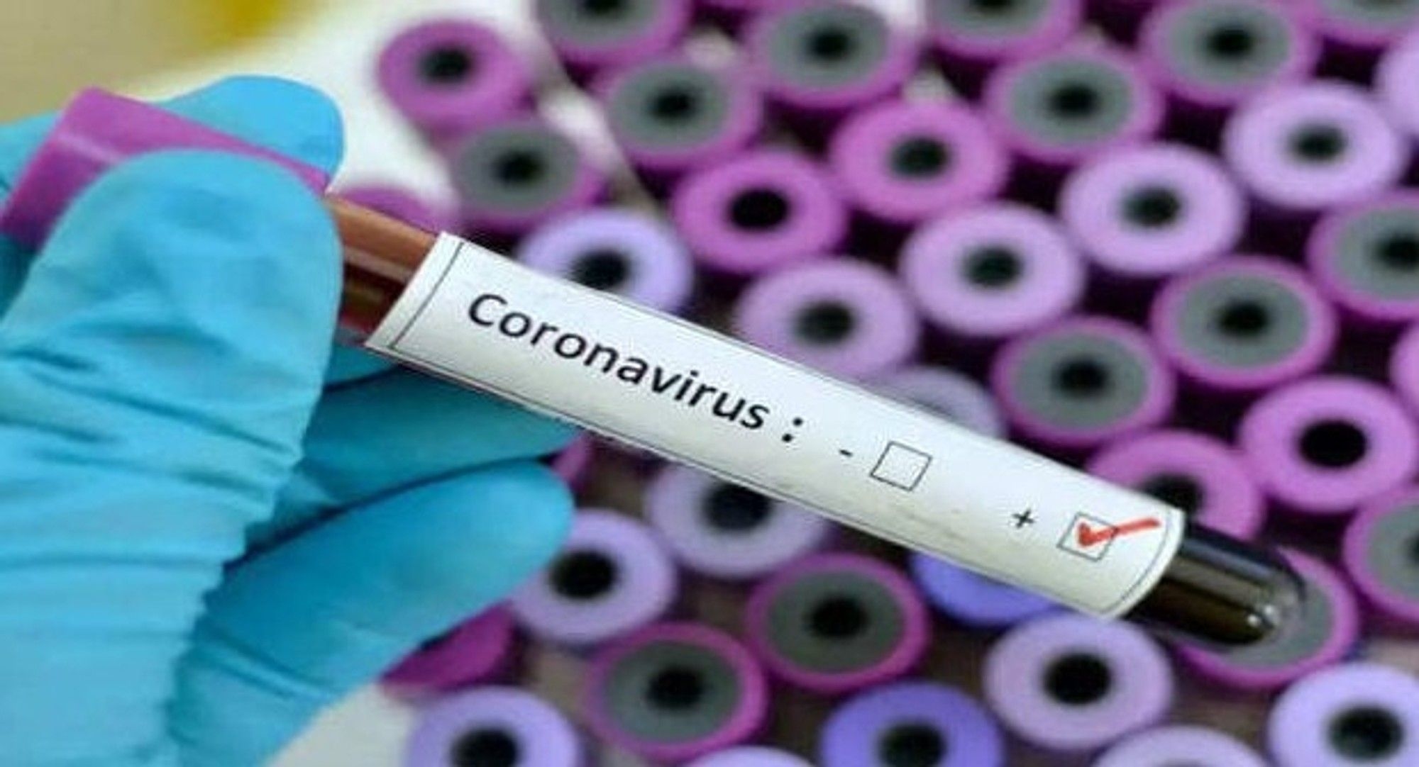Unmasking the 'Zombie' Cells: The shocking link between ME/CFS and Long Covid