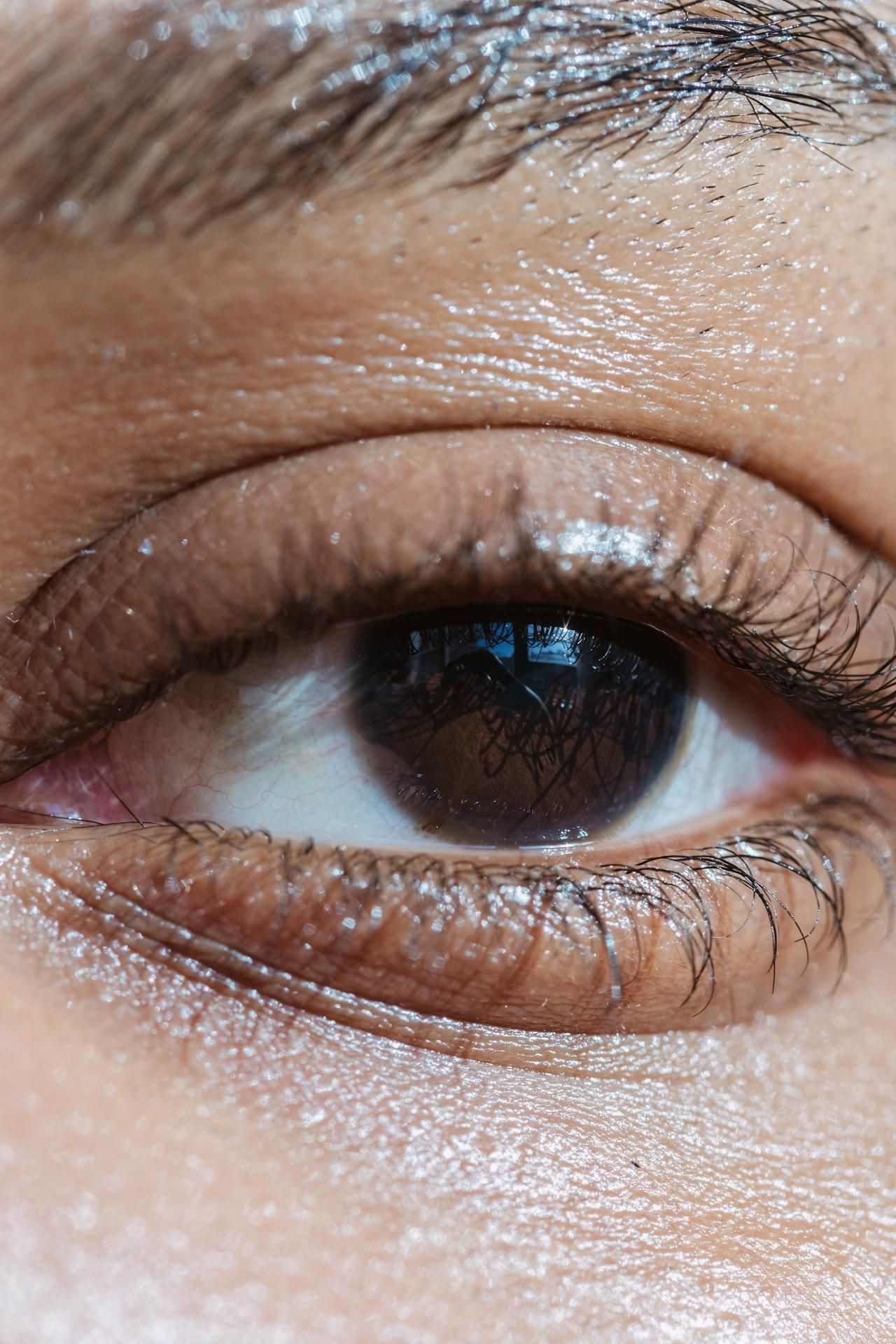Eye-popping risks: what you should know about cosmetic eye colour surgery