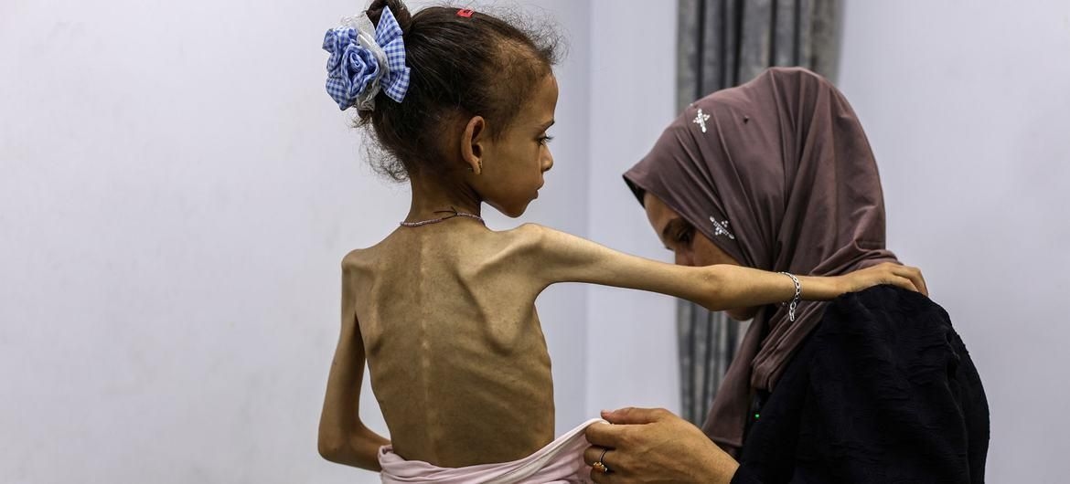 The worst-case scenario: famine declared in Gaza amid ongoing conflict