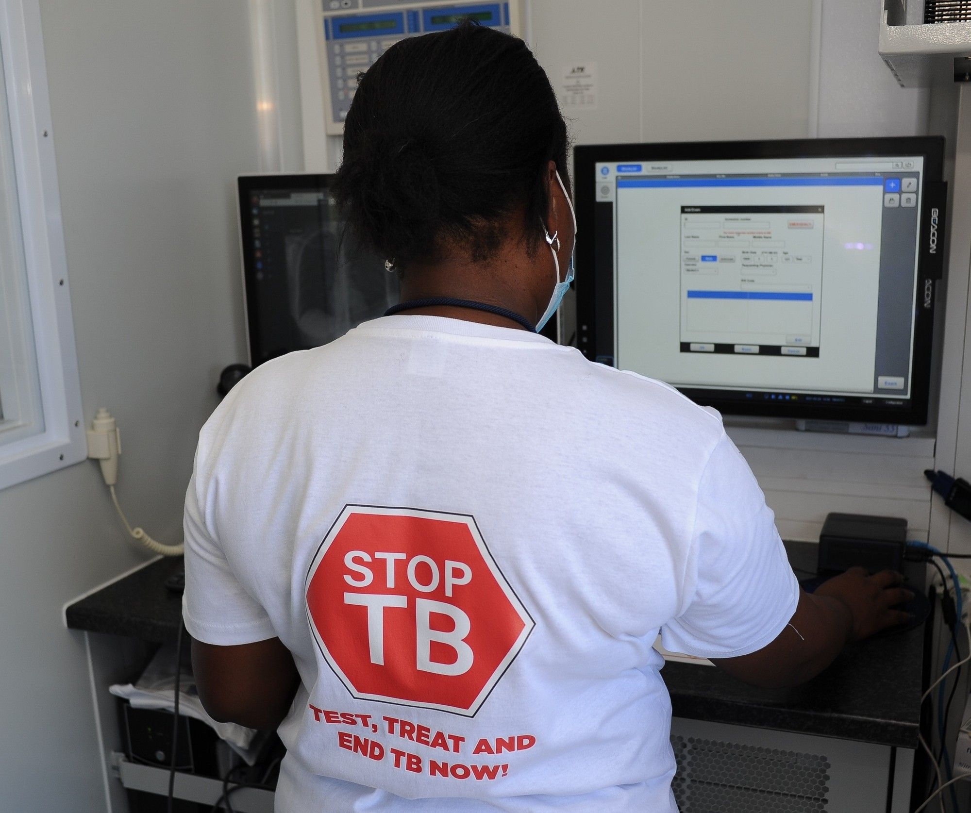 Durban sites play pivotal role in global TB vaccine trial