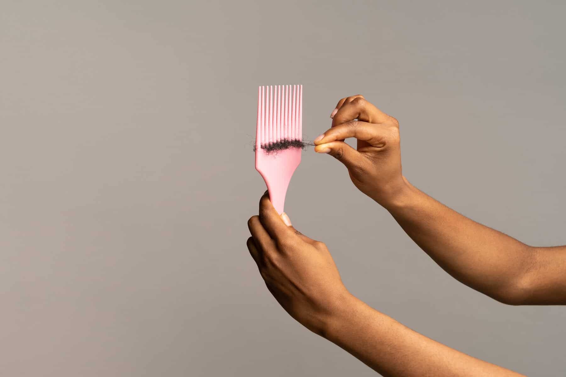 No hairline? How to stop hair loss in Afro-textured hair today!
