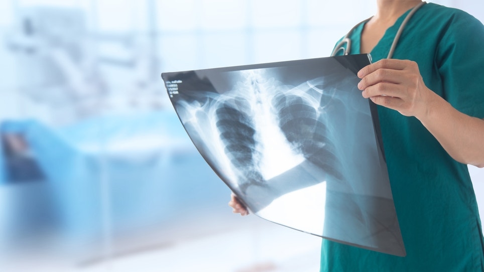 MAIA Biotechnology's Experimental Cancer Drug Shows Tripled Survival Vs. Standard Chemotherapy In Pretreated Lung Cancer Patients